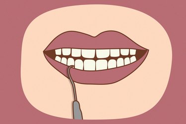 illustration of a person scraping tartar off their teeth with a dental cleaning instrument on a dark pink background