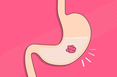 an illustration of a piece of gum in a stomach on a dark pink background